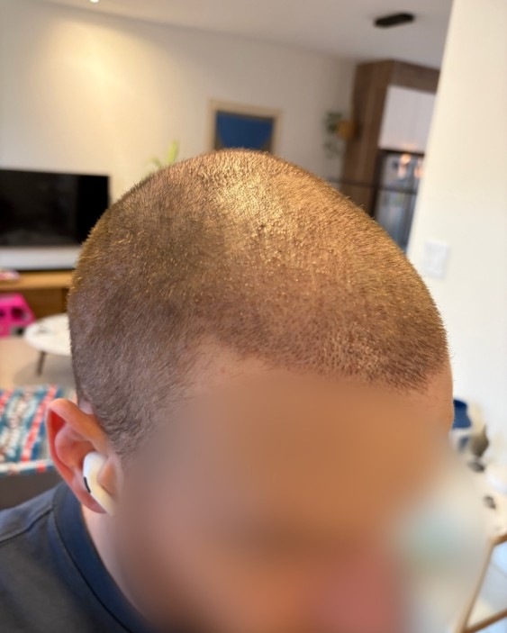 De profil intervention