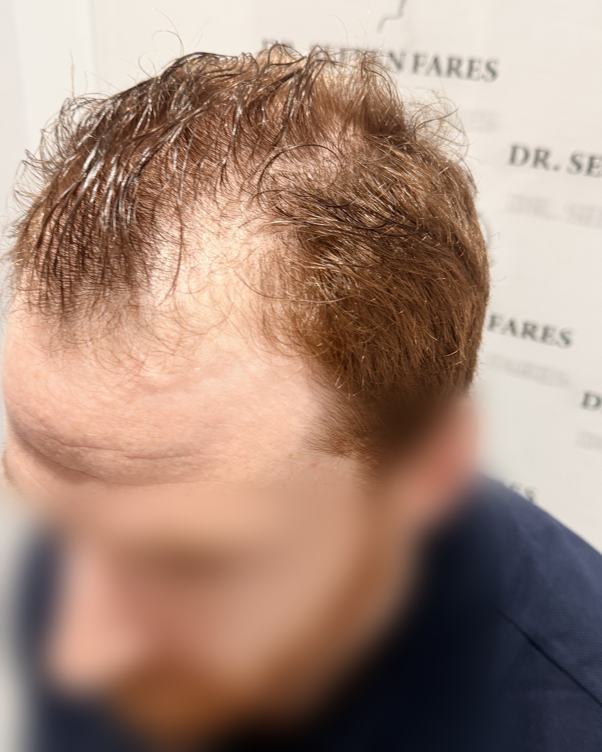 De profil intervention