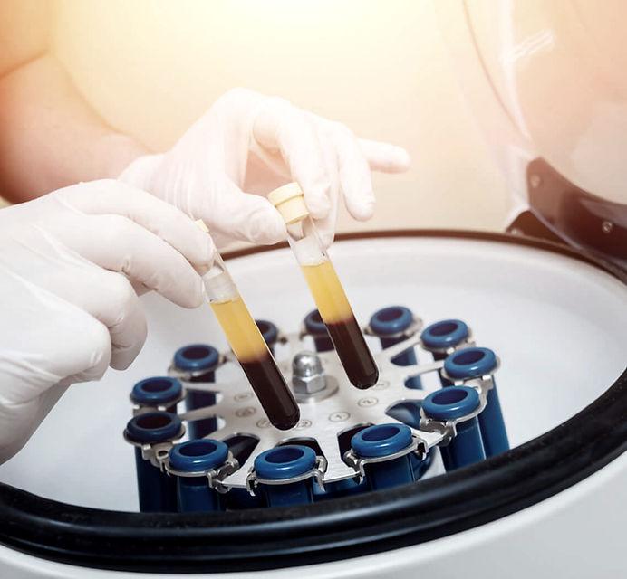 Tubes de sang placés dans une centrifugeuse pour préparer le PRP