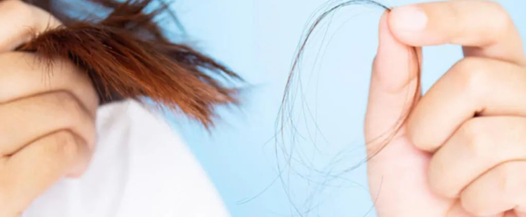 Hair loss