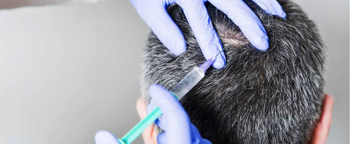 injections de prp