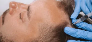 PRP for hair, Tunisia