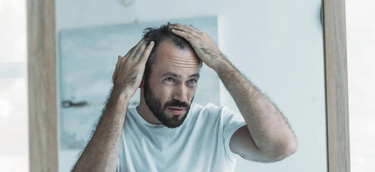 Drug treatments for hair loss