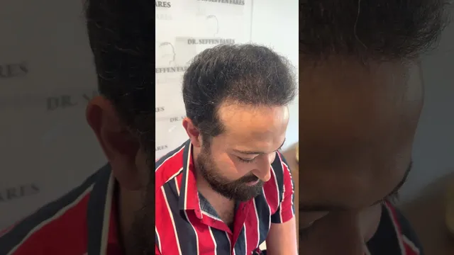 Résultat à sept mois