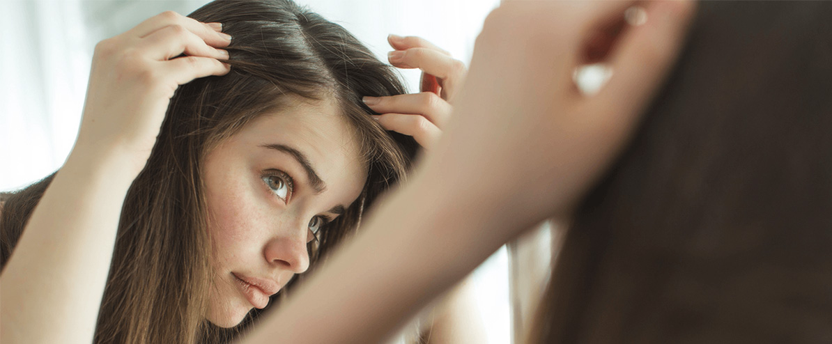 chute de cheveux