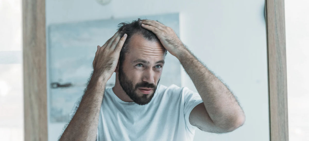 Traitements médicamenteux contre la chute de cheveux